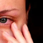 Visual representation of watery eyes and their common causes