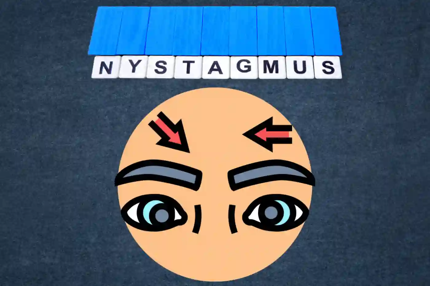 Nystagmus