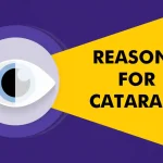 Causes of Cataract