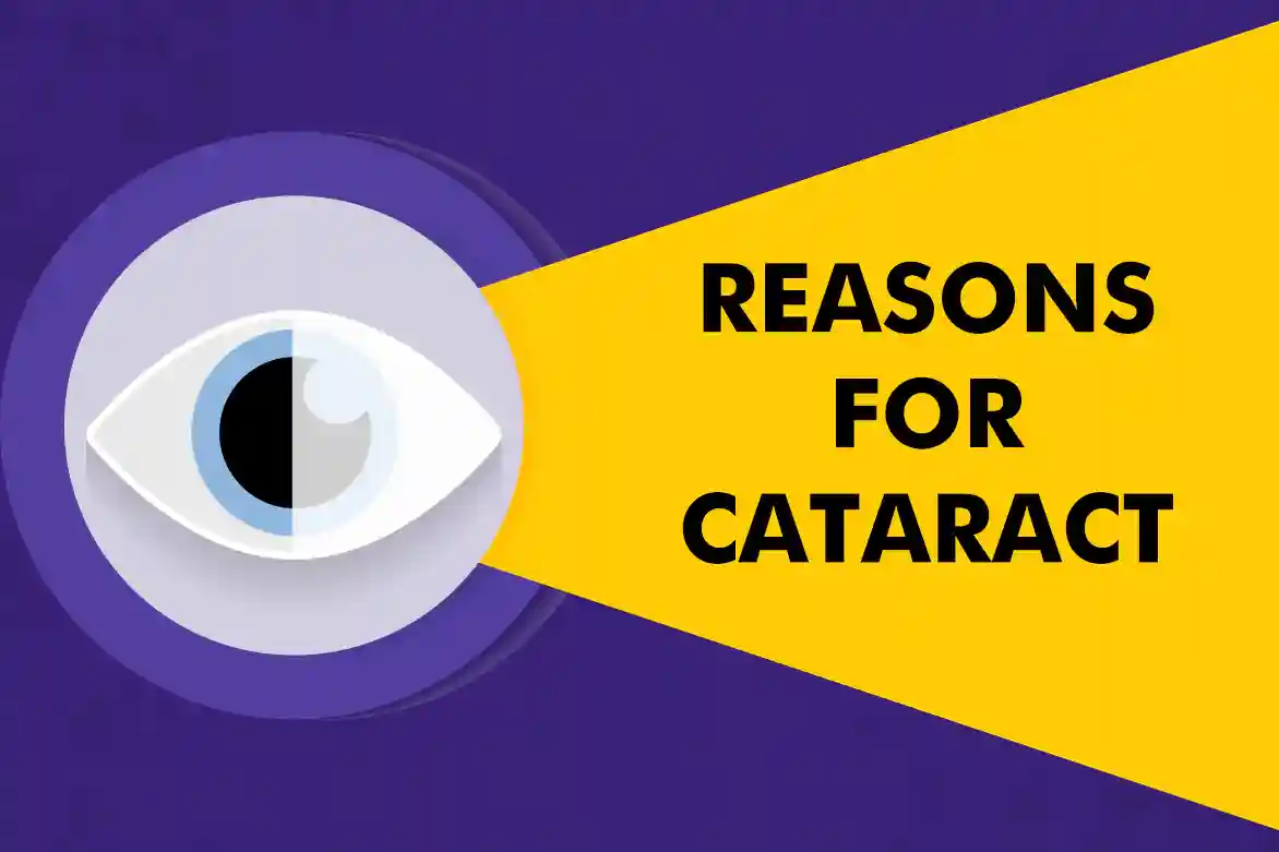 Causes of Cataract