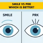 SMILE Surgery vs PRK