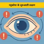 ग्लूकोमा के शुरुआती लक्षण जिन्हें नज़रअंदाज़ नहीं करना चाहिए