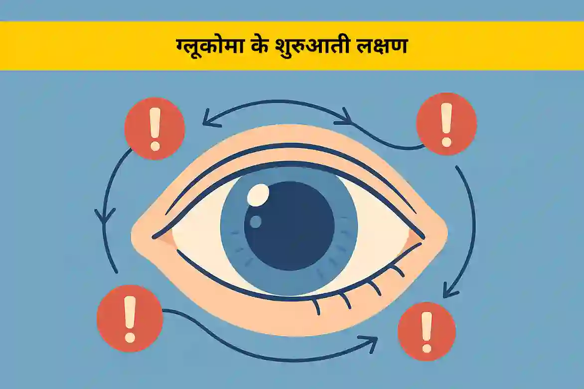 ग्लूकोमा के शुरुआती लक्षण जिन्हें नज़रअंदाज़ नहीं करना चाहिए