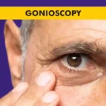 Gonioscopy procedure