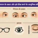 भेंगापन (स्क्विंट) के प्रकार और इलाज के आधुनिक विकल्प