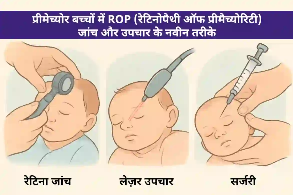 प्रिमैच्योर बच्चों में ROP (रेटिनोपैथी ऑफ प्रिमैच्योरिटी)