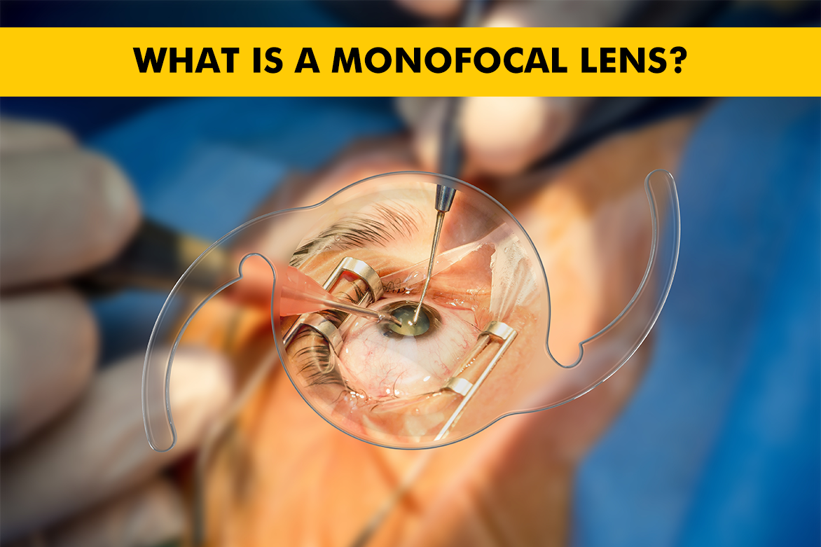 Monofocal Lenses